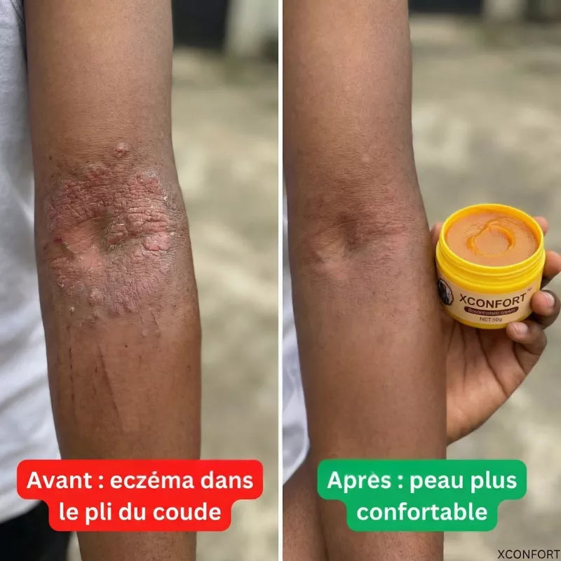 Avant apres 5