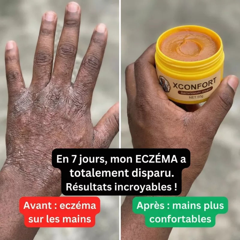Avant apres 2