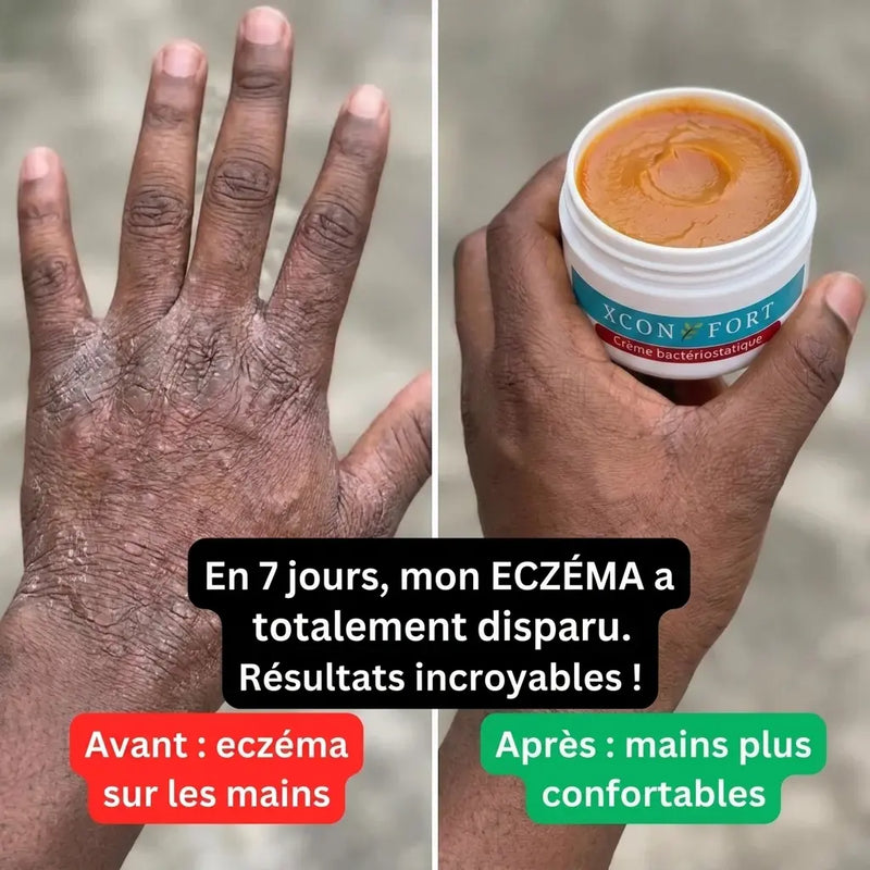 Avant apres 2