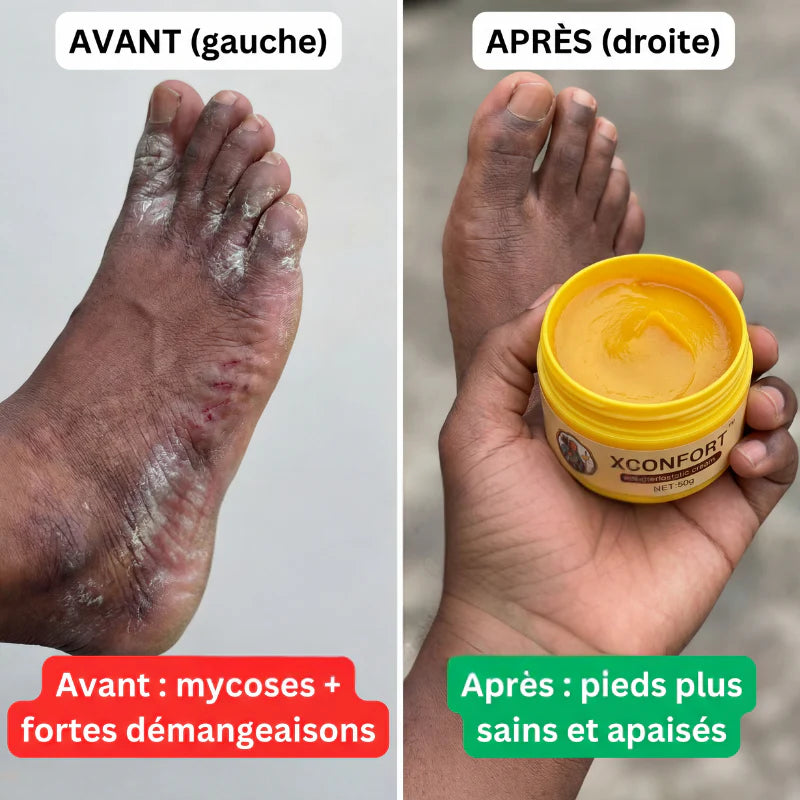 Avant apres 6