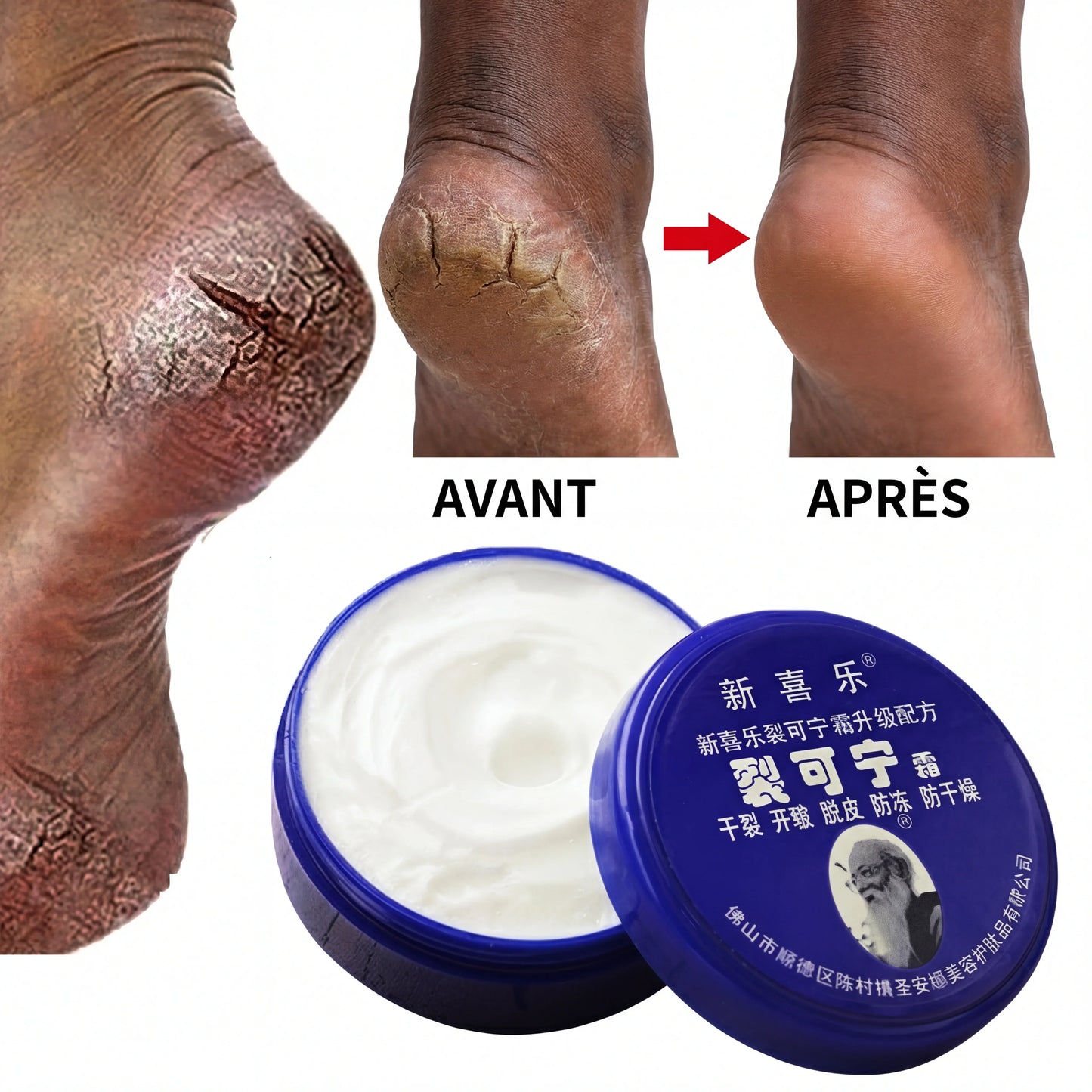 Soin Anti-Fissures des Pieds SEC-NAT
