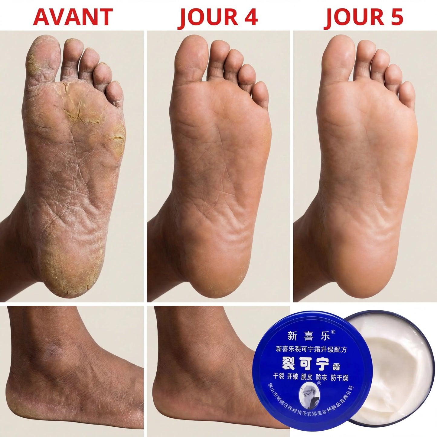 Soin Anti-Fissures des Pieds SEC-NAT