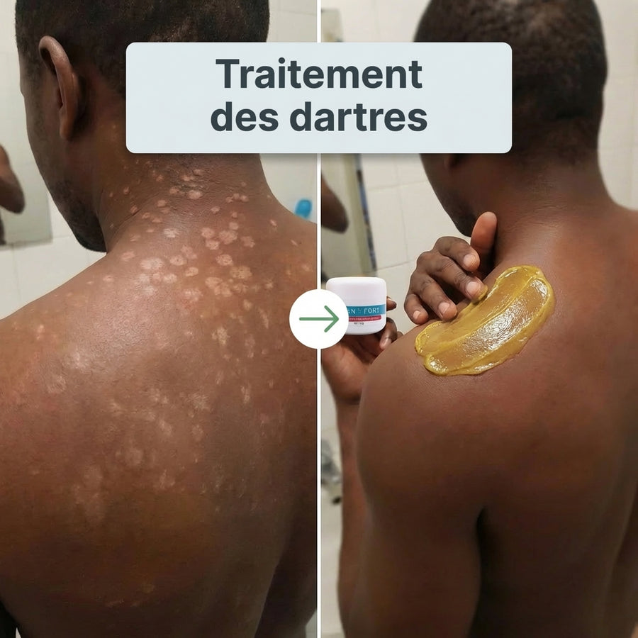 X-CONFORT - CRÈME TRAITEMENT POUR LA PEAU