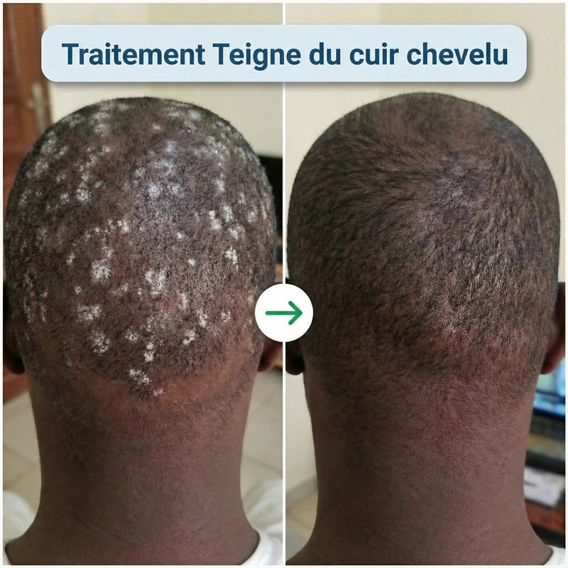 Avant apres 4