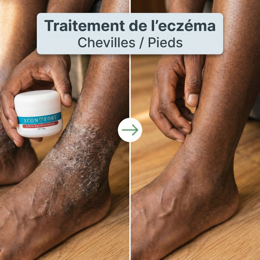 X-CONFORT - CRÈME TRAITEMENT POUR LA PEAU