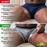 Traitement Intime Abidjan — Infections & Démangeaisons Éliminées en 7 Jours (Même les Cas Chroniques)