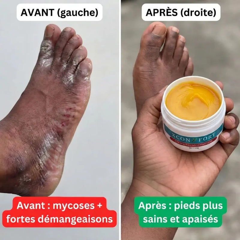 Avant apres 6
