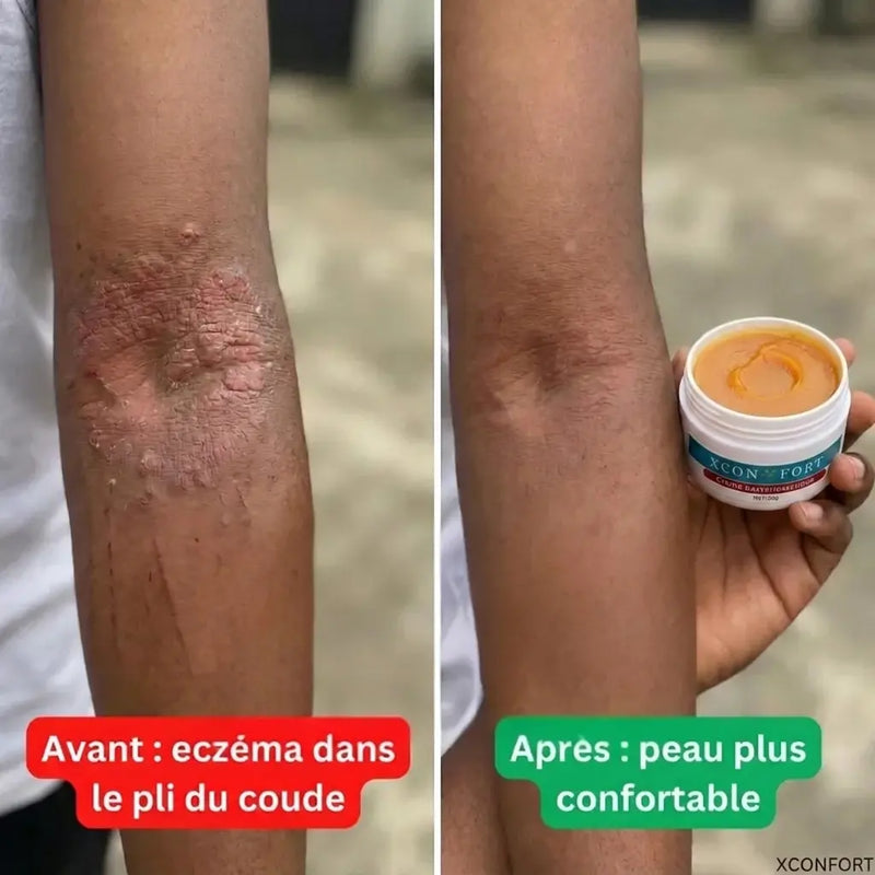 Avant apres 5